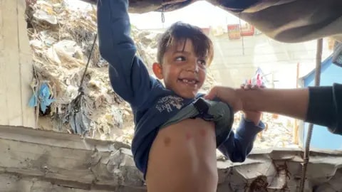 'If we sleep, they bite': Rats and weasels infest camps for displaced Gazans - foto 3